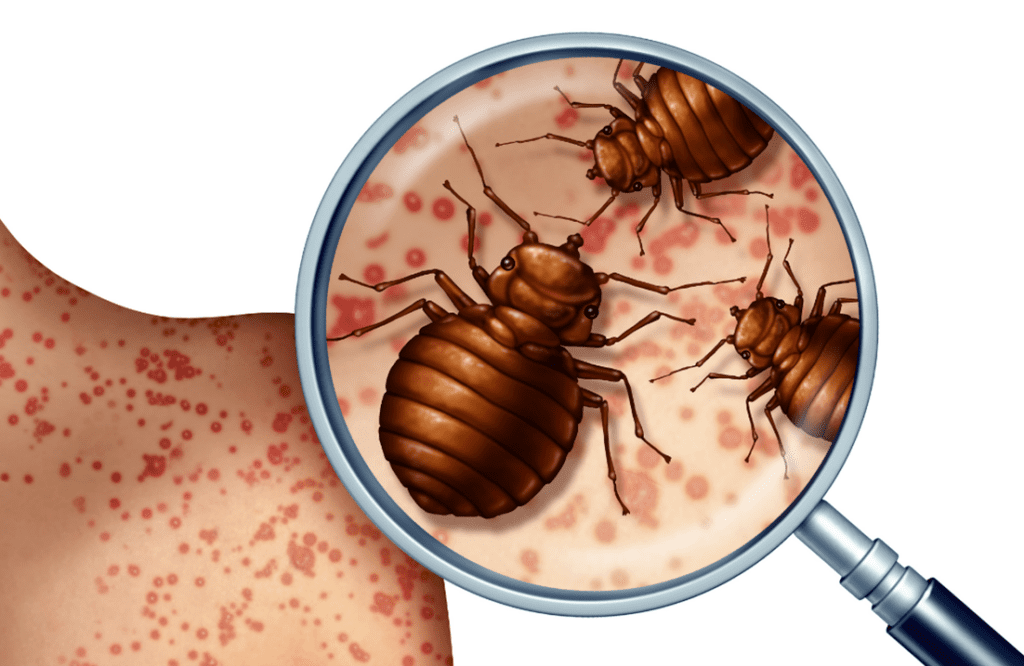 What to Do if You Suspect Bed Bugs Have Infested Your Home? Tri County Termite & Pest Control