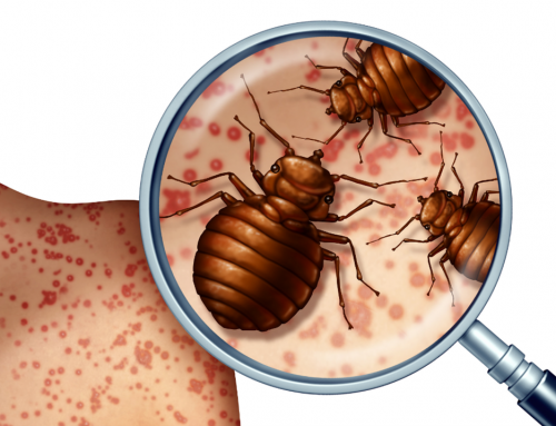 What Is the Best Way to Keep Ants, Spiders, and Bugs Out of Your Greeley Home?