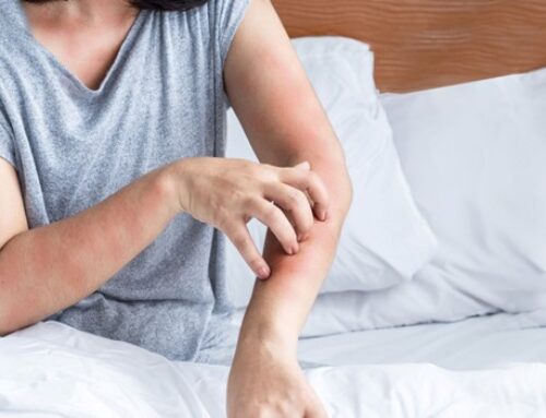 Scary Facts About Bed Bugs and Why You Need a Bed Bug Treatment in Louisburg